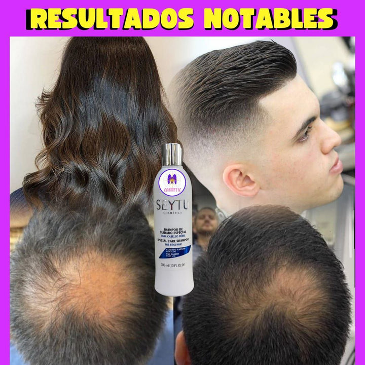 Shampoo de Cuidado Especial Para Cabello Débil